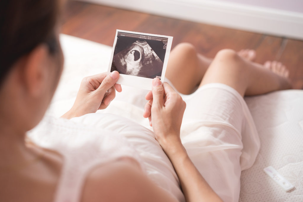 mother looking at a sonogram of a baby